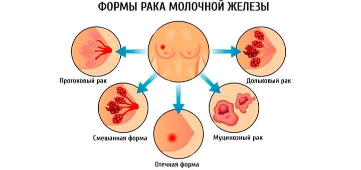 формы рмж